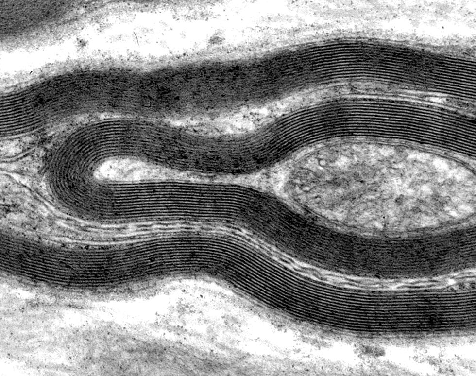 Myelinated nerve
